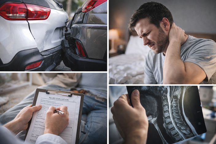 Minor Crash, Major Injuries: Late Symptoms & Delayed Treatment